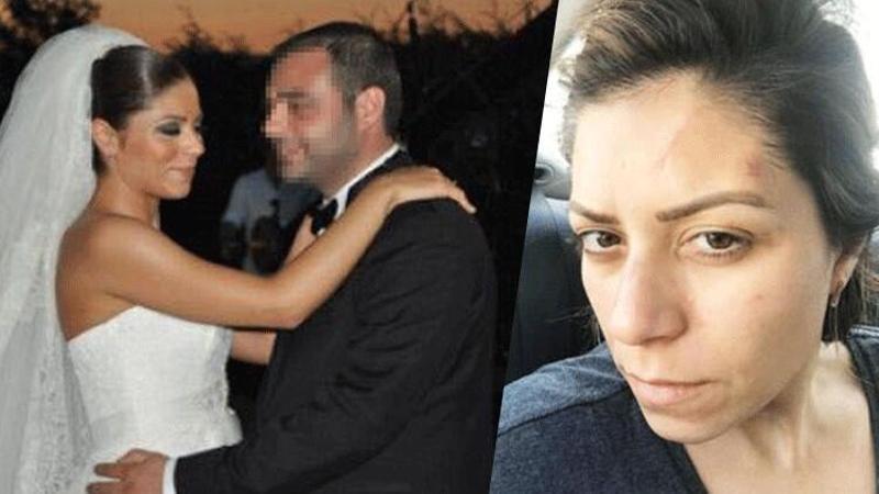 Boşandığı eşinden şiddet gören avukat, yaşadığı dehşeti anlattı