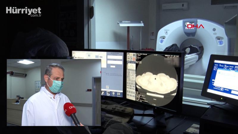 Akciğer tomografisiyle erken teşhis, kovid'e bağlı ölümleri azalttı