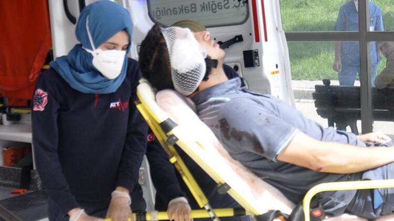 Tartıştığı postacının kulağını ısırarak kopardı