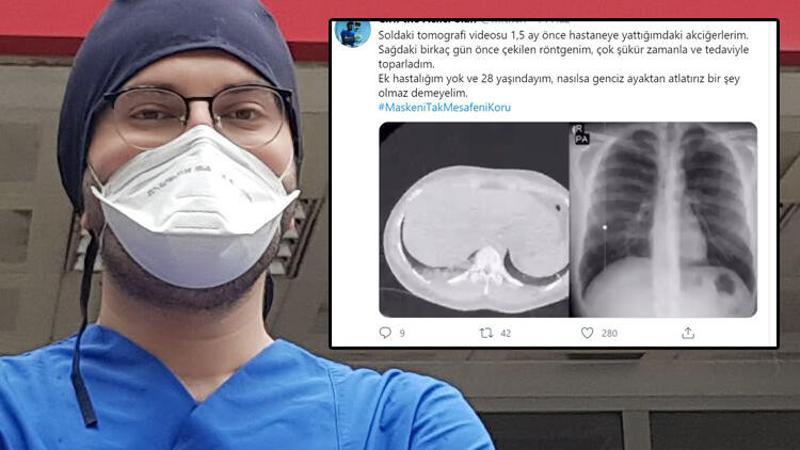Koronavirüsü yenen genç doktor uyardı: Nasılsa genciz ayakta atlatırız, demeyin