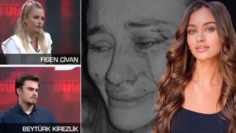 Son dakika haberler... Ukraynalı model Daria Kyryliuk'ı kim darbetti? Görgü tanıkları CNN TÜRK'te anlattı