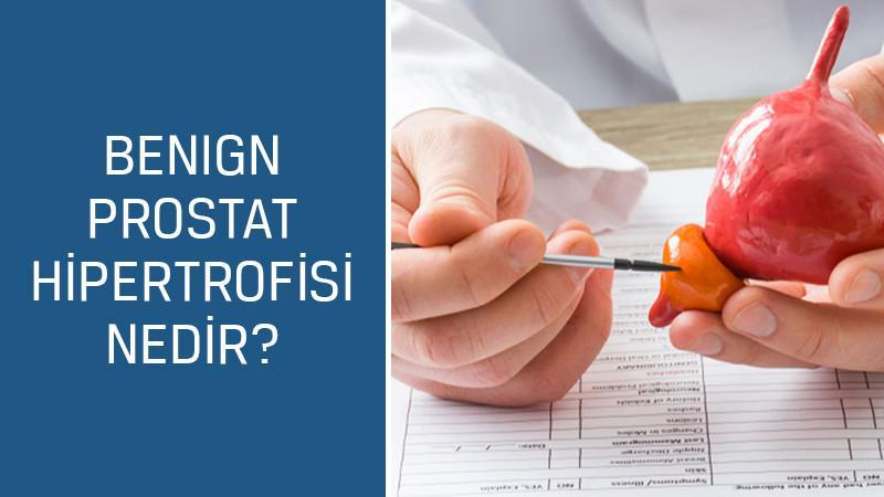 Üroloji Uzmanı Doç. Dr. Mustafa Kıraç cevaplıyor; Benign prostat hipertrofisi nedir, belirtileri ve tedavisi nasıldır?