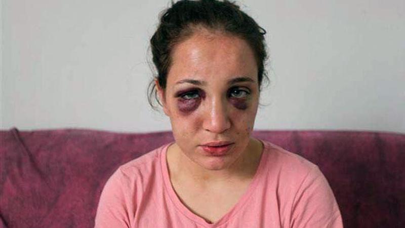 Eşinden şiddet gören Özlem: Döverek bayıltıp, su dökerek ayılttığını her yerde anlatıyordu