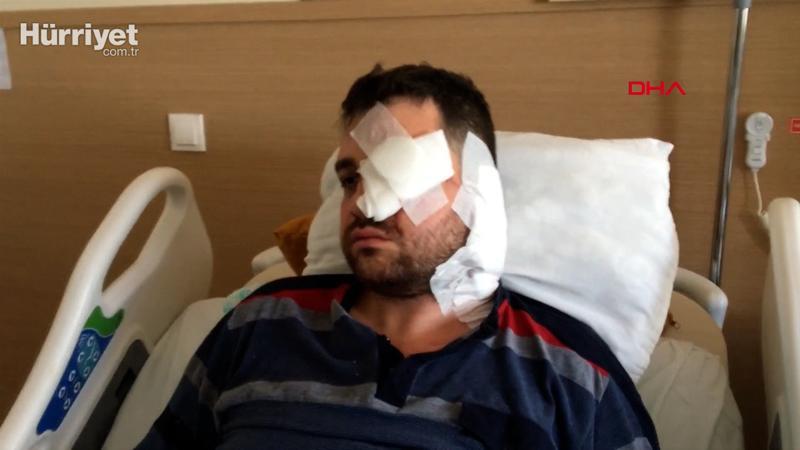 Bıçaklı saldırıda sol gözünü kaybeden avukat: Beni öldürmeye gelmiş