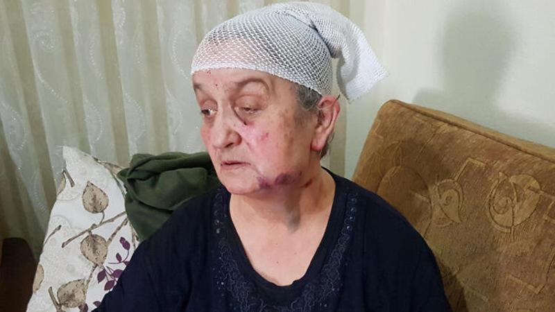 Yaşlı kadın, hırsızdan ölü taklidi yaparak kurtuldu