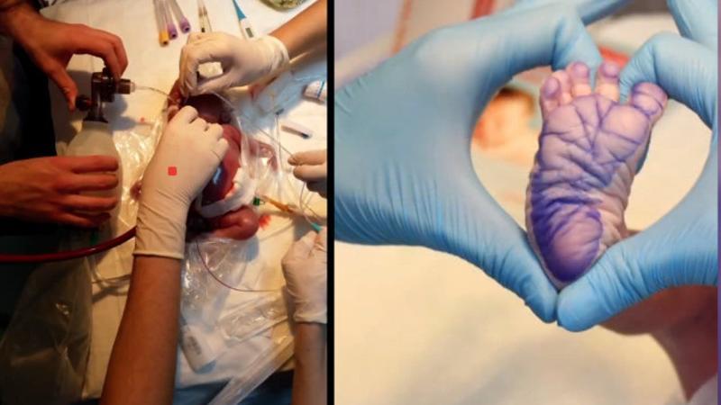 Erken doğan bebeklerin videosu Avrupa'da ödül aldı