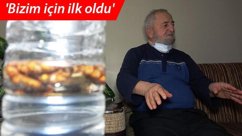 Koronavirüsten şüphelenmişti, akciğerinden ceviz çıktı