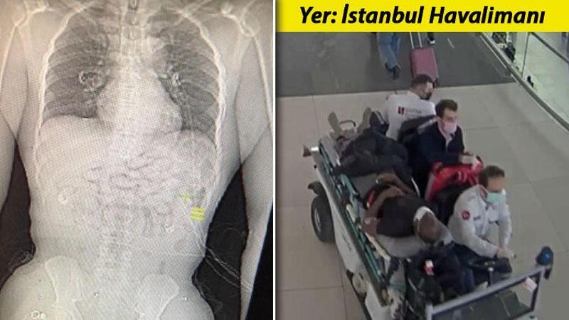 Ganalı yolcunun midesinden uyuşturucu çıktı
