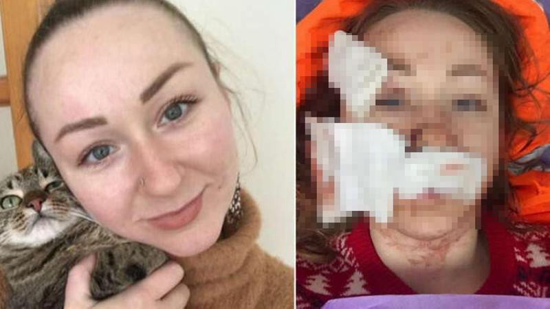Falçatalı saldırıya uğrayan Ukraynalı kadın Anna B, o anları anlattı