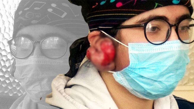 Keloid teşhisi konulan Yağmur, yardım bekliyor