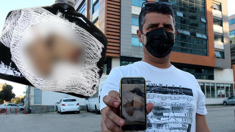 Elinde havai fişek patladı, parmakları koptu! Sahibini sosyal medyada aradı