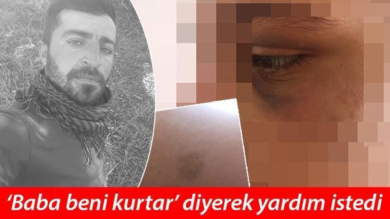 Dini nikahlı eşini 6 ay boyunca zincire bağlayıp, işkence yaptı; tutuklandı