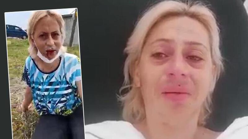 Sokak hayvanlarını beslerken saldırıya uğradı; Çenesi kırıldı