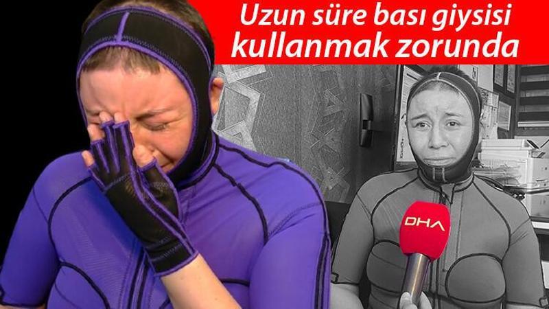 Benzin dökülerek ateşe verilmişti! Yaşadığı dehşeti gözyaşlarıyla anlattı