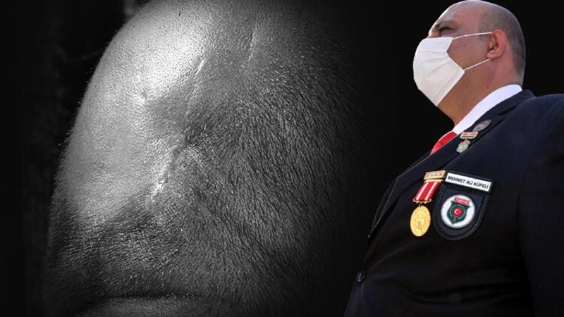 Güneydoğu gazisi, 13 yıldır kafasındaki Kalaşnikof mermisi ile yaşıyor