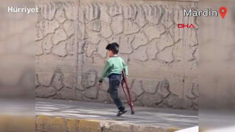 3 yaşındaki Muhammet için protez bacak siparişi verildi