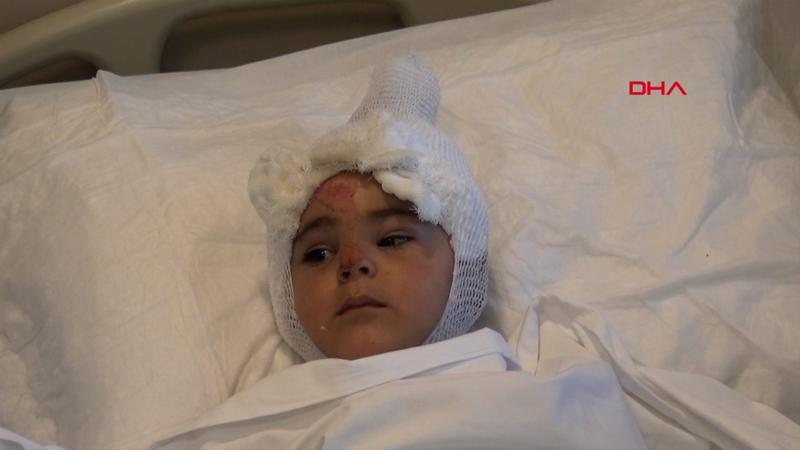 Tandıra düşen 2 yaşındaki Eylül yaralandı