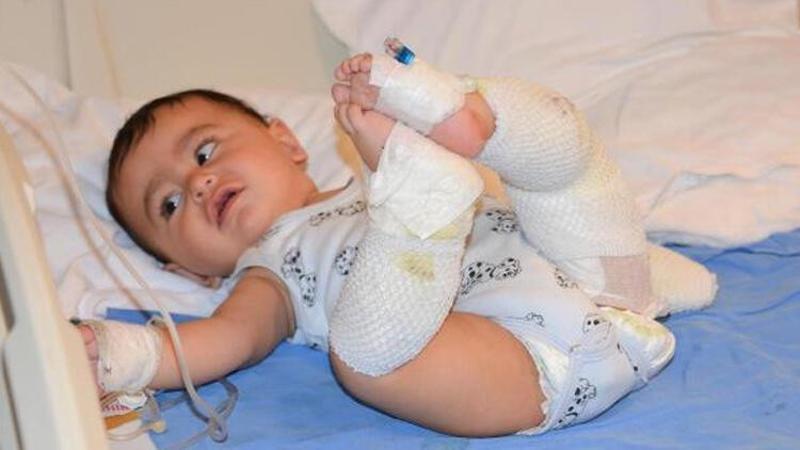 Çaydanlığı üzerine deviren İsmail bebek yaralandı
