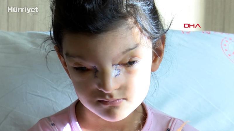 Ayşenur'un gözleri arasındaki mesafe 3 santime düşürüldü