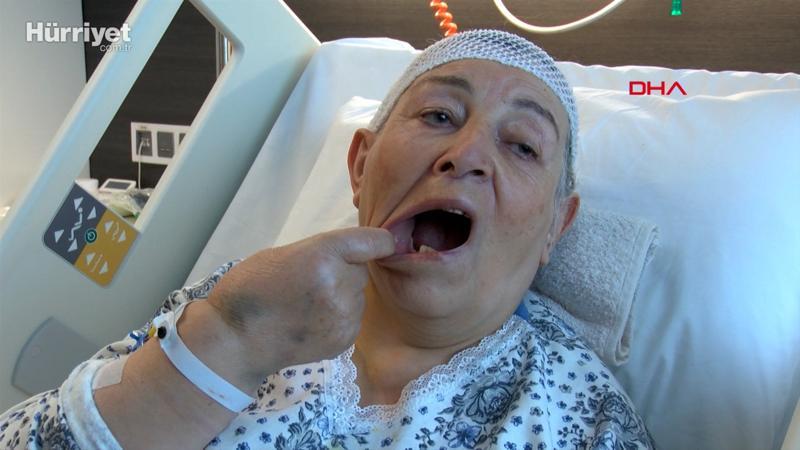 'Delirten hastalık'ta 5 dişinden oldu