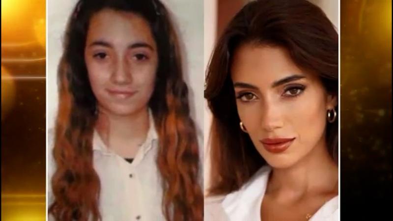Rachel Araz estetik iddialarına ilk kez “teve 2 Magazin Masası”nda cevap verdi…