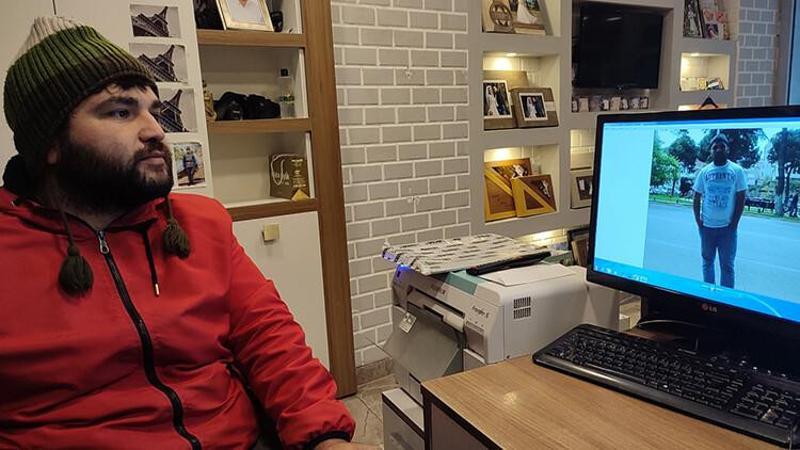 Ordu'da sivilce enfeksiyonu tekerlekli sandalyeye mahkum etti