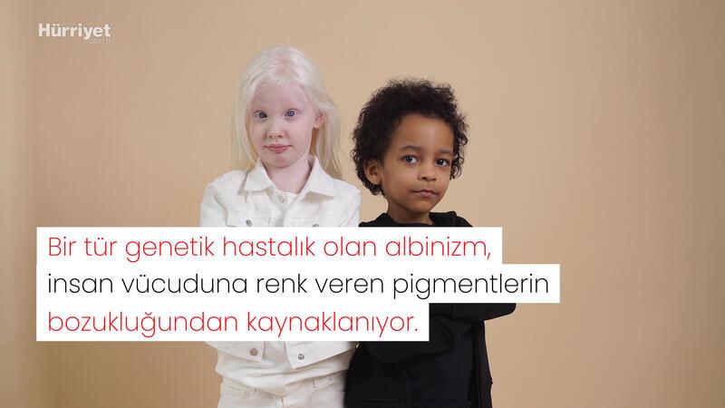 Albinolara adanan bir ömür: Afrika'nın Türk Annesi 'Mama Turkey'