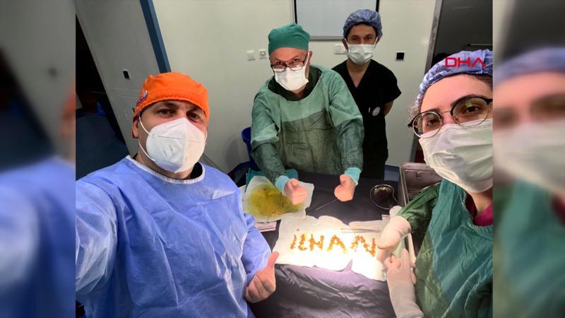 Safra kesesinden 1250 taş çıktı, doktor ismini yazdı