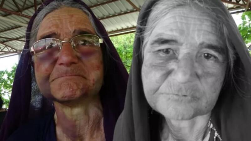 Adana'da 70 yaşındaki kadın, sürüye karışan kuzusunu almak isterken feci şekilde darp edildi
