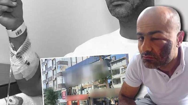 Lazer epilasyon yaptırmak istedi hayatı kâbusa döndü