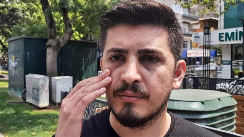 Hemşirenin kafatası ve burnunu kırmıştı! Yeniden gözaltında
