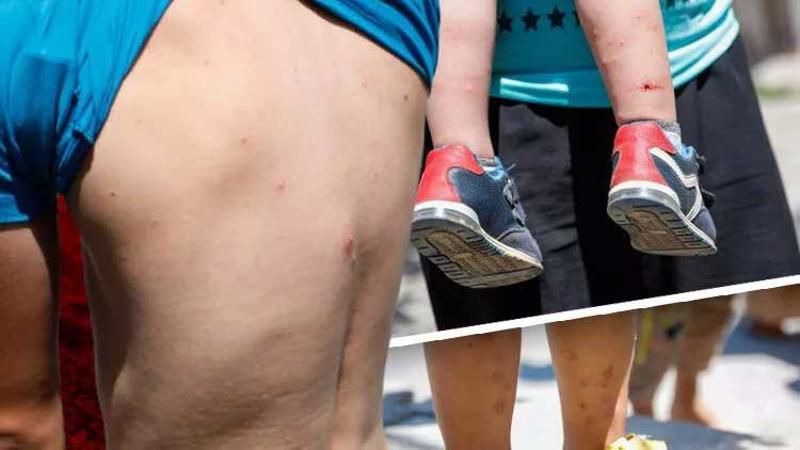 İstanbul'da 'Aedes' sivrisineği tehdidi
