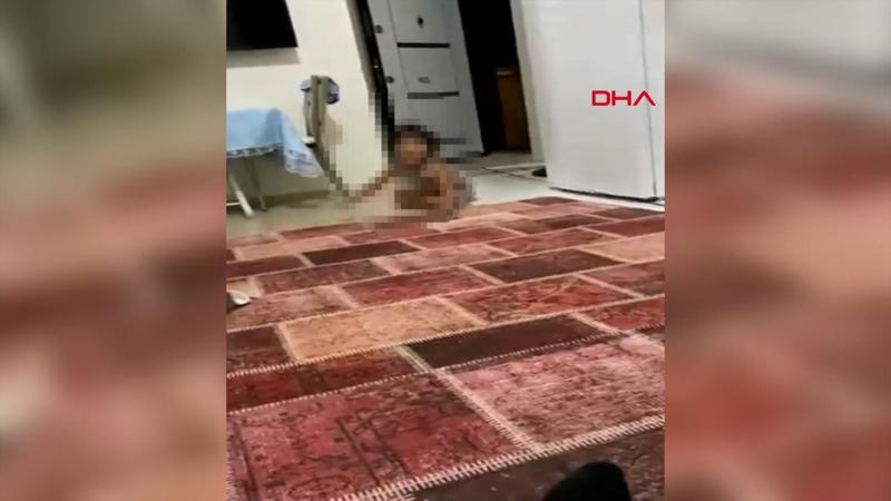 Pitbull saldırısında yaralanan Asiye'nin görüntüleri tepki çekti