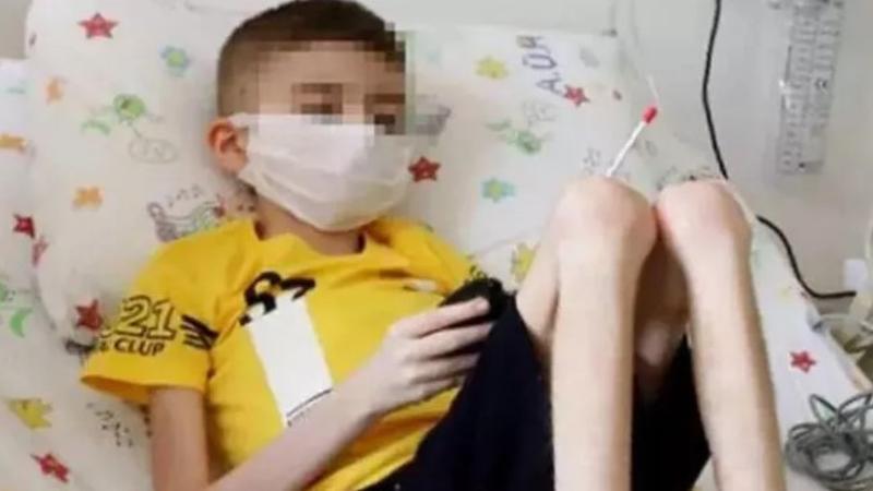 Çöp evde bulunan Cem Muhammet, 20 kiloya ulaştı
