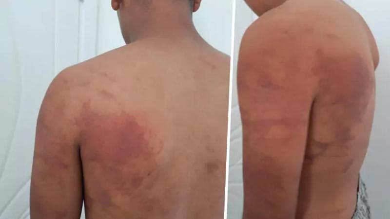 Baba ve amcanın 16 yaşındaki çocuğu zincirle bağlayıp işkence ettiği iddiası