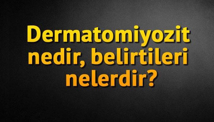 Dermatomiyozit nedir belirtileri nelerdir?