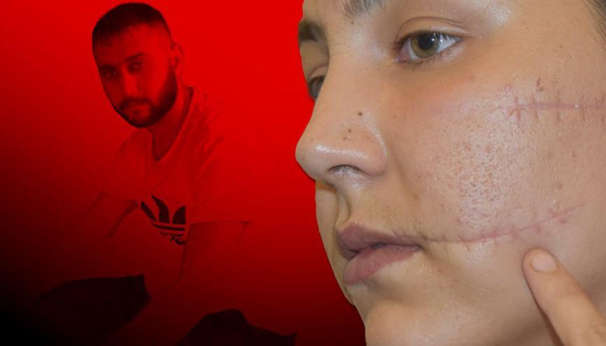 Birlikte yaşadığı kadını 104 yerinden bıçakladı... Savunması şaşkına çevirdi Birlikte yaşadığı kadını 104 yerinden bıçakladı... Savunması şaşkına çevirdi