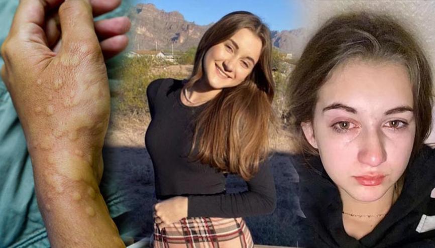 Dünyada 32 kişi bu hastalığı yaşıyor: Ağlamak bile yasak En son bir yıl önce su içtim Dünyada 32 kişi bu hastalığı yaşıyor: Ağlamak bile yasak En son bir yıl önce su içtim