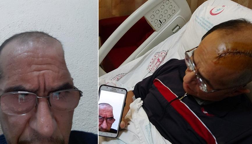 Hastanın kafatasına 3 boyutlu yazıcıyla üretilen yapay kemik yerleştirildi Hastanın kafatasına 3 boyutlu yazıcıyla üretilen yapay kemik yerleştirildi